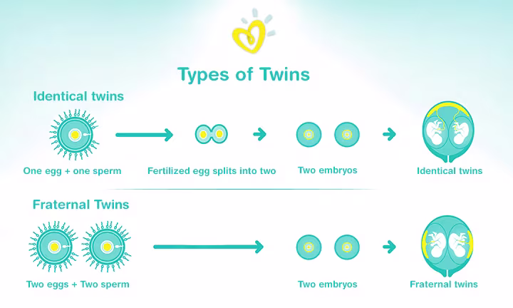 Types of Twins in Mother’s Womb