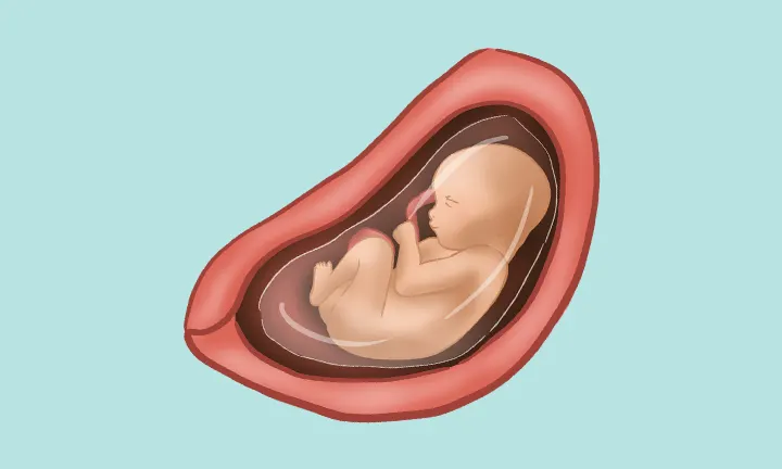 Baby Lage in der 28 SSW