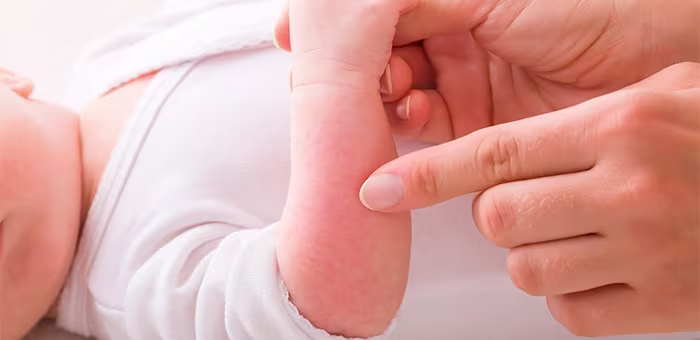 Mamá toca a su bebé. Alergia en bebés.