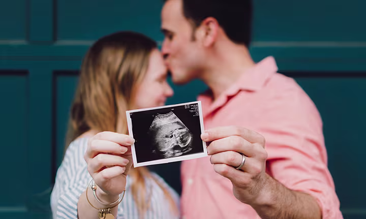 What Are 3D and 4D Ultrasound Scans?