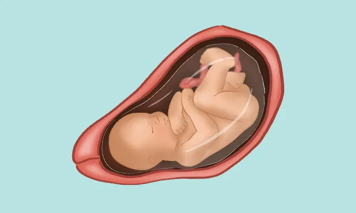 Lage des Babys in der 34. SSW Lage des Babys in der 34. SSW
