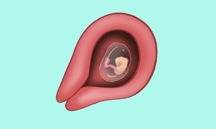 Embryolage in der 5. SSW