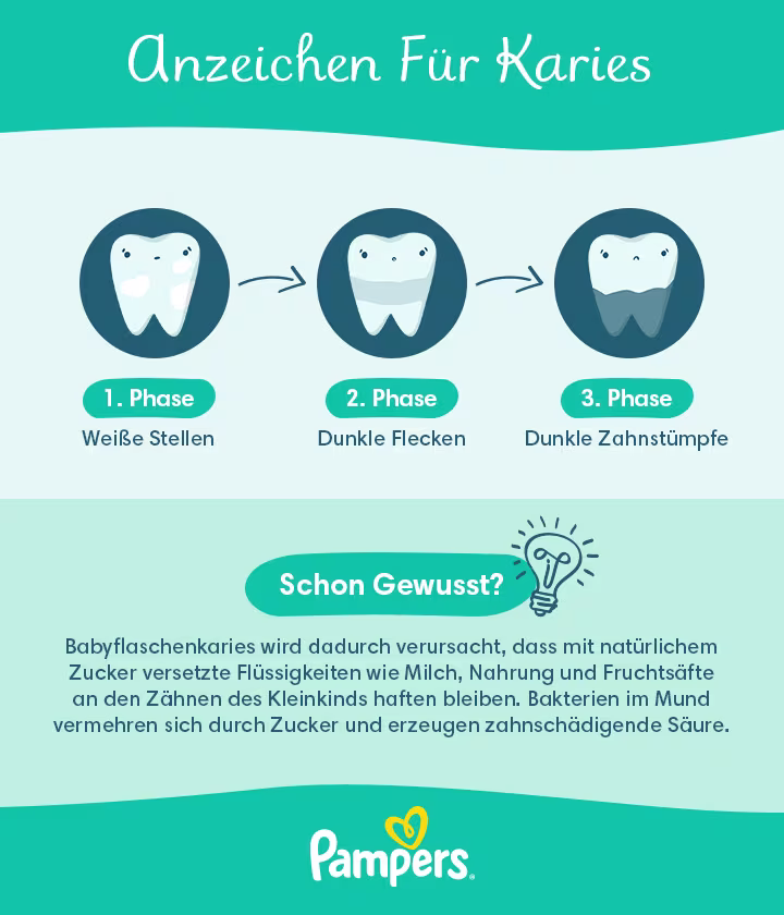 Anzeichen für Karies