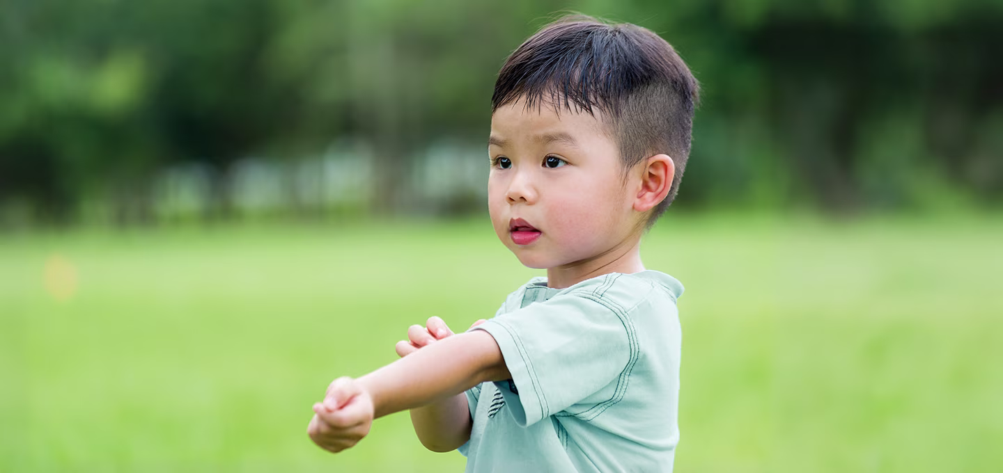 Mosquito Bites on Babies