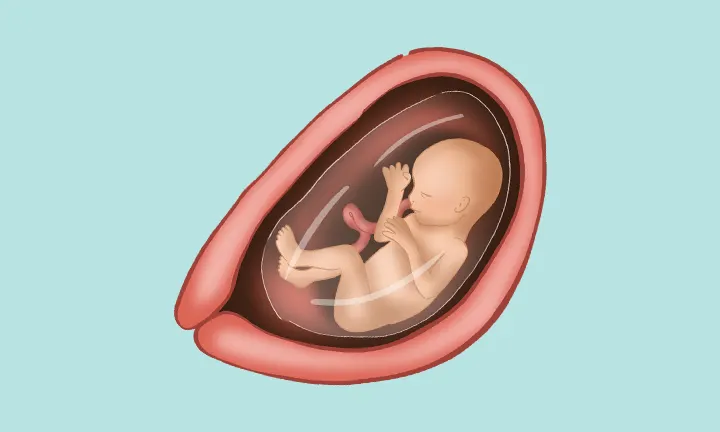 Embryolage in der 18. SSW Embryolage in der 18. SSW