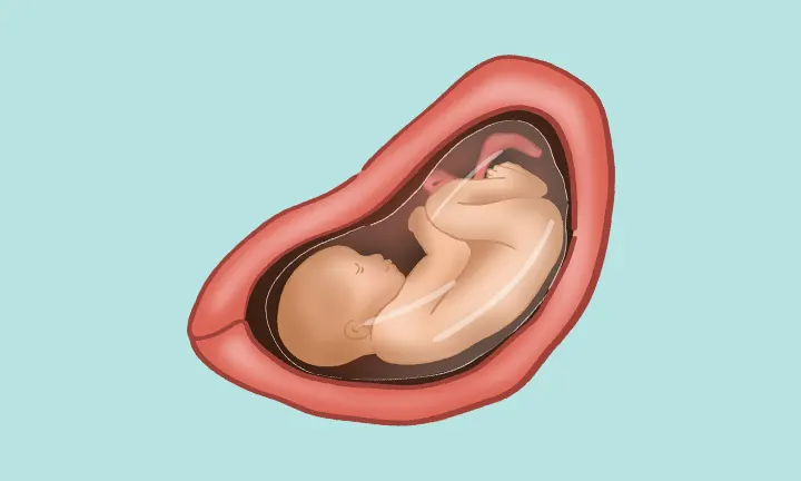 29. Schwangerschaftswoche - Lage & Größe Fötus in der 29. Woche