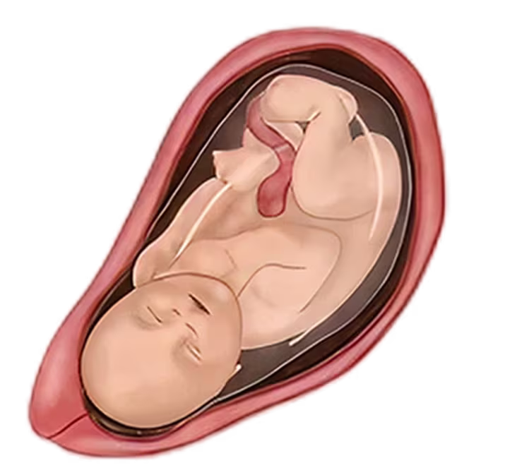 Illustration of a fetus at 40 weeks, demonstrating its position within the uterus with the umbilical cord visible. Illustration of a fetus at 40 weeks, demonstrating its position within the uterus with the umbilical cord visible.