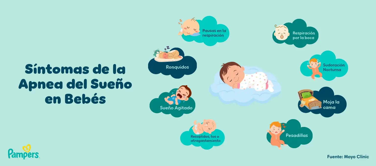 Síntomas de la apnea del sueño en bebés