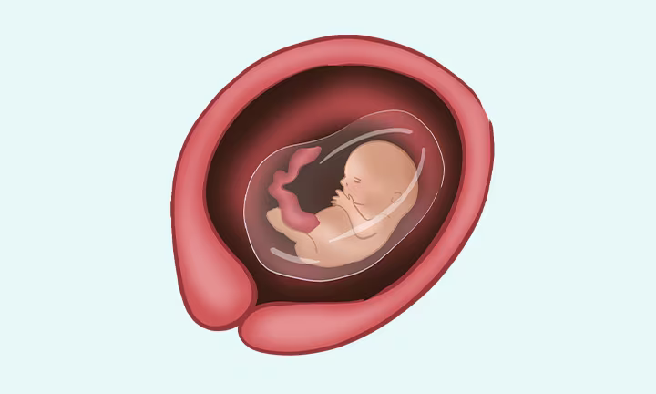 jak wyglada plod w 13 tyg ciazy