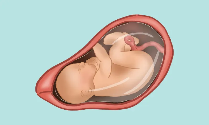 Lage des Babys in der 38. SSW Lage des Babys in der 38. SSW