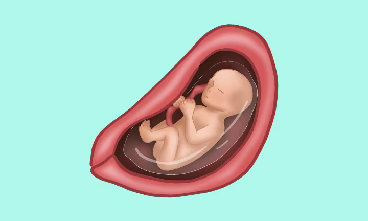 Lage des Babys in der 24. SSW