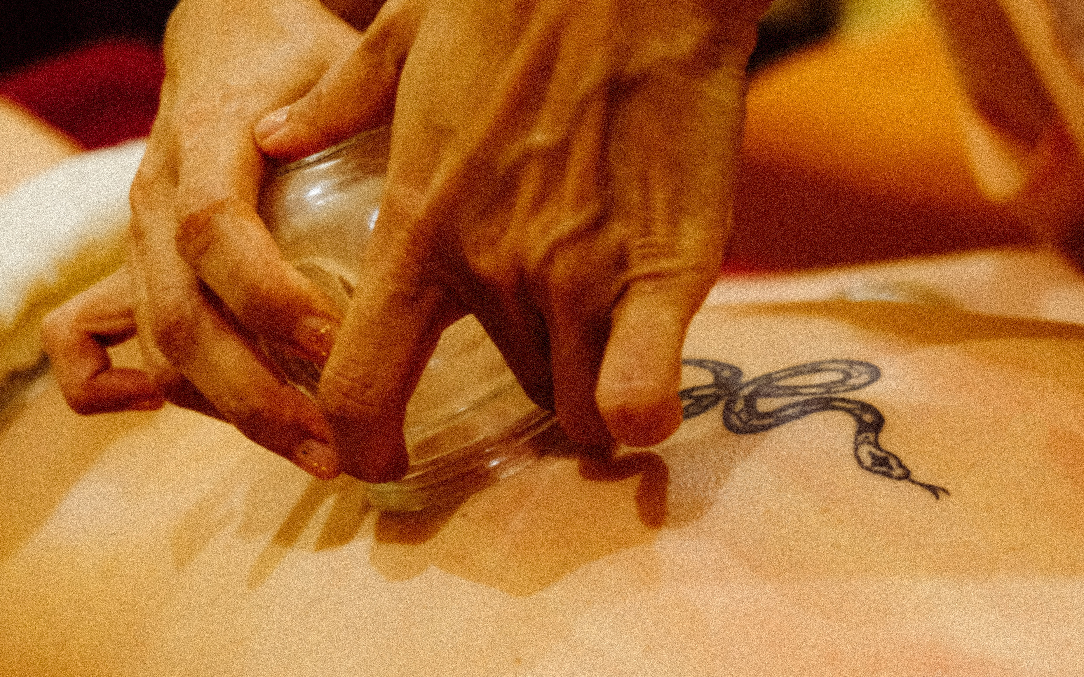 Cupping therapy