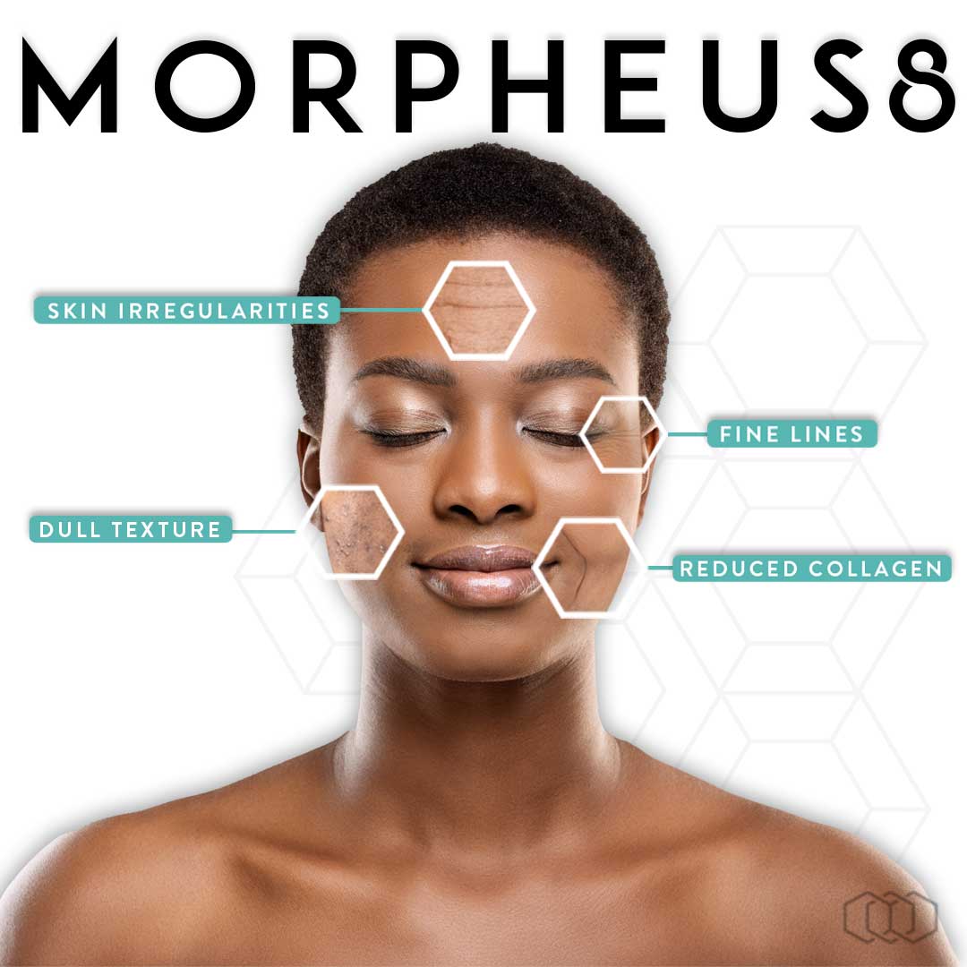 Morpheus8 - Safe for all skin types