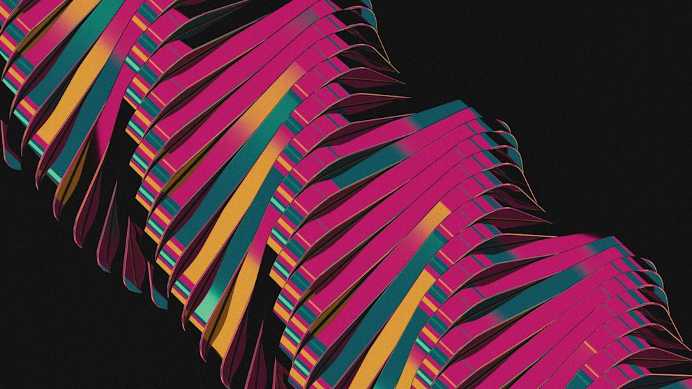 State of AI in Accounting 2025