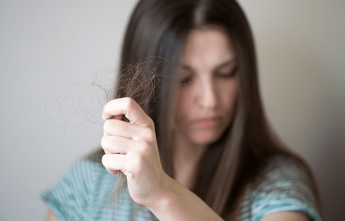 Hair Loss in Women