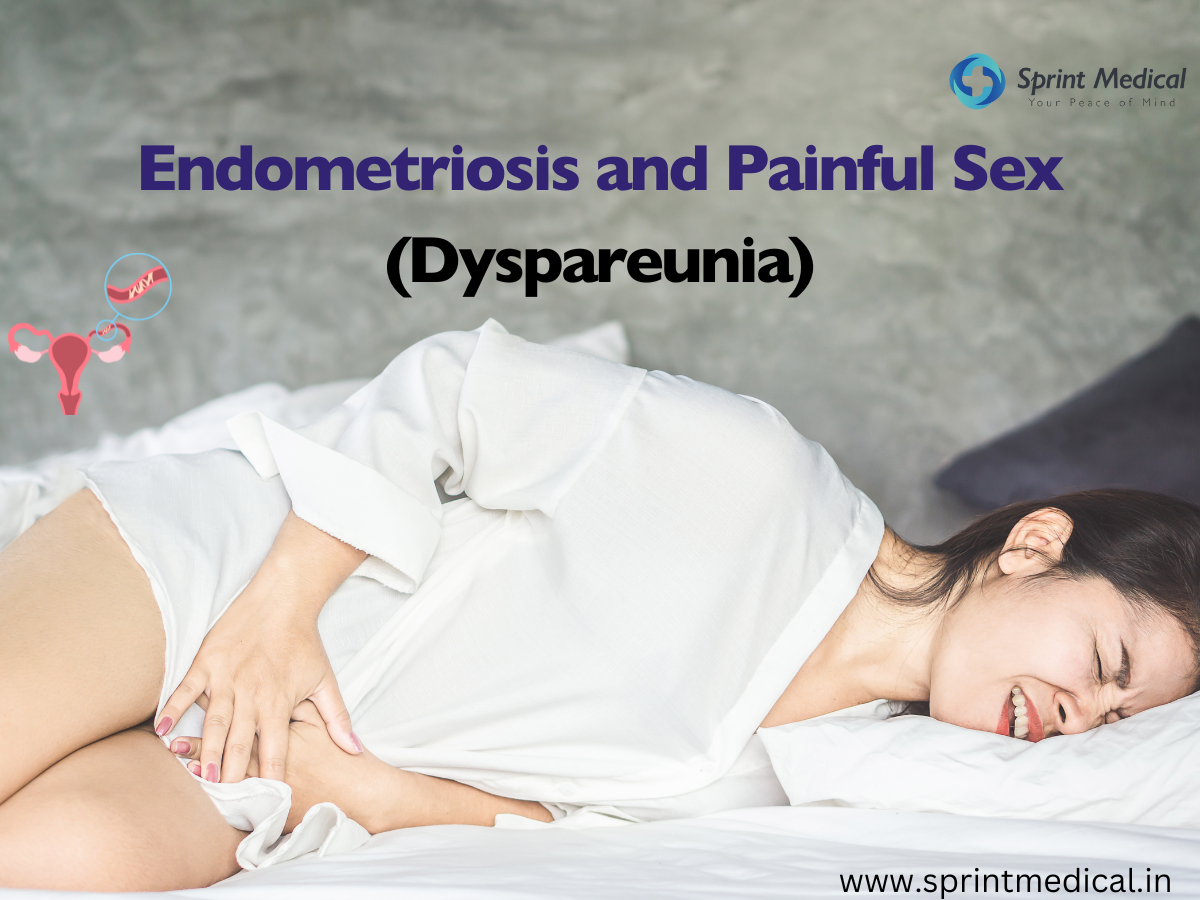 Endometriosis and Painful Sex