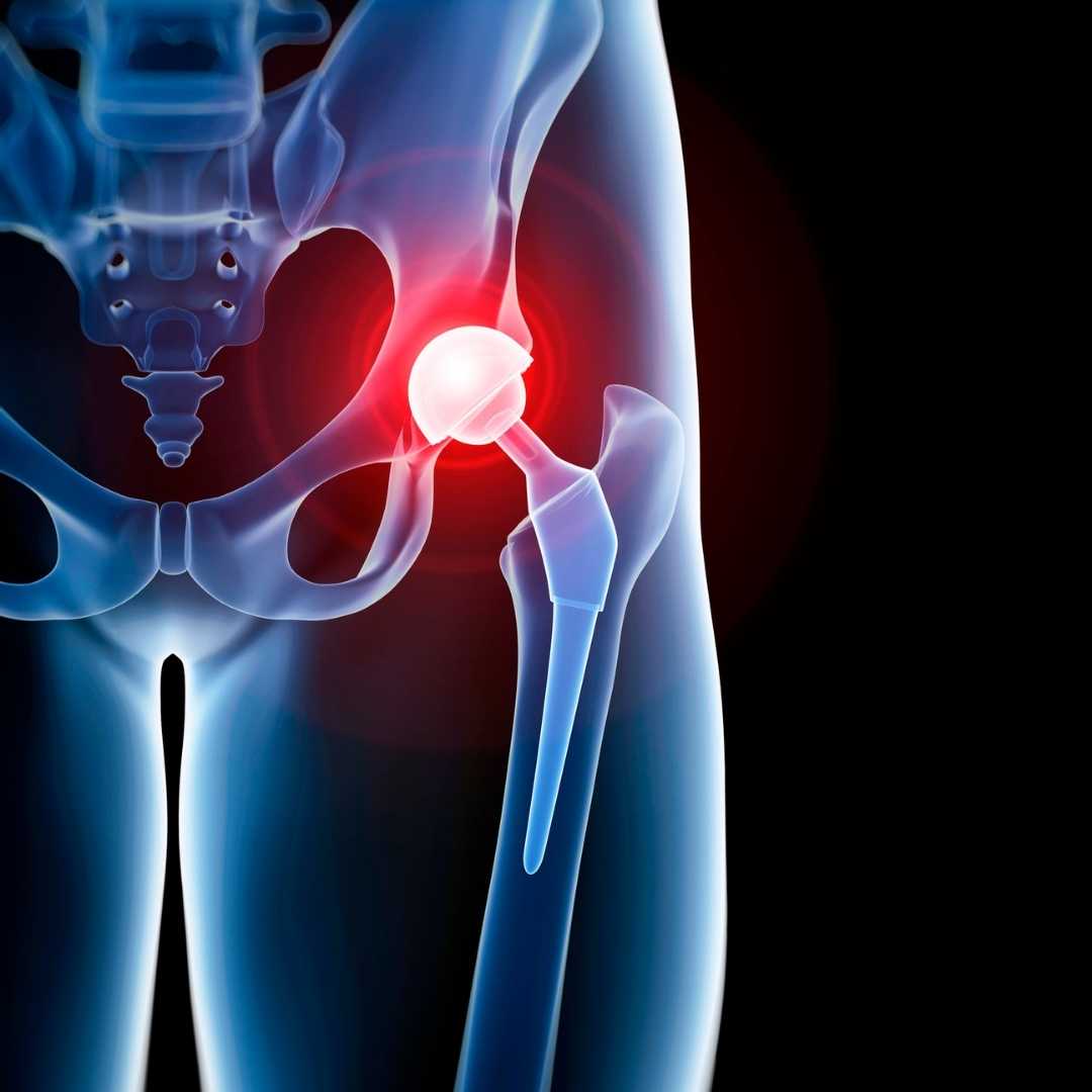 Application of biomaterial in healthcare and medicine