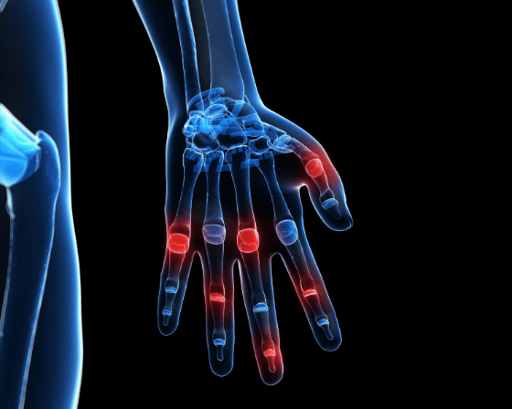 Top Reasons Why You Should Go and See an Orthopedic Hand Surgeon?