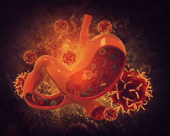 Stomach Ulcers- Symptoms, Causes, and Treatment