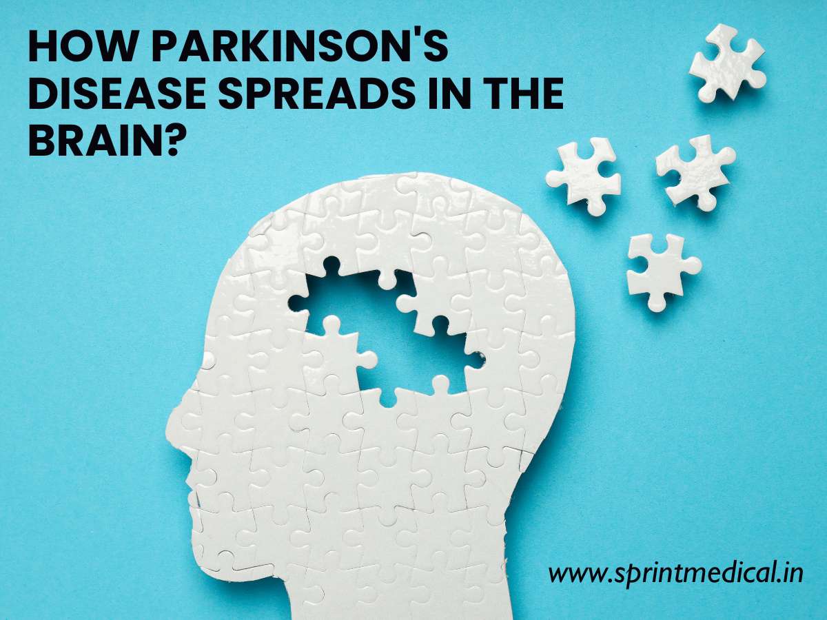 How Parkinson-s disease spreads in the Brain