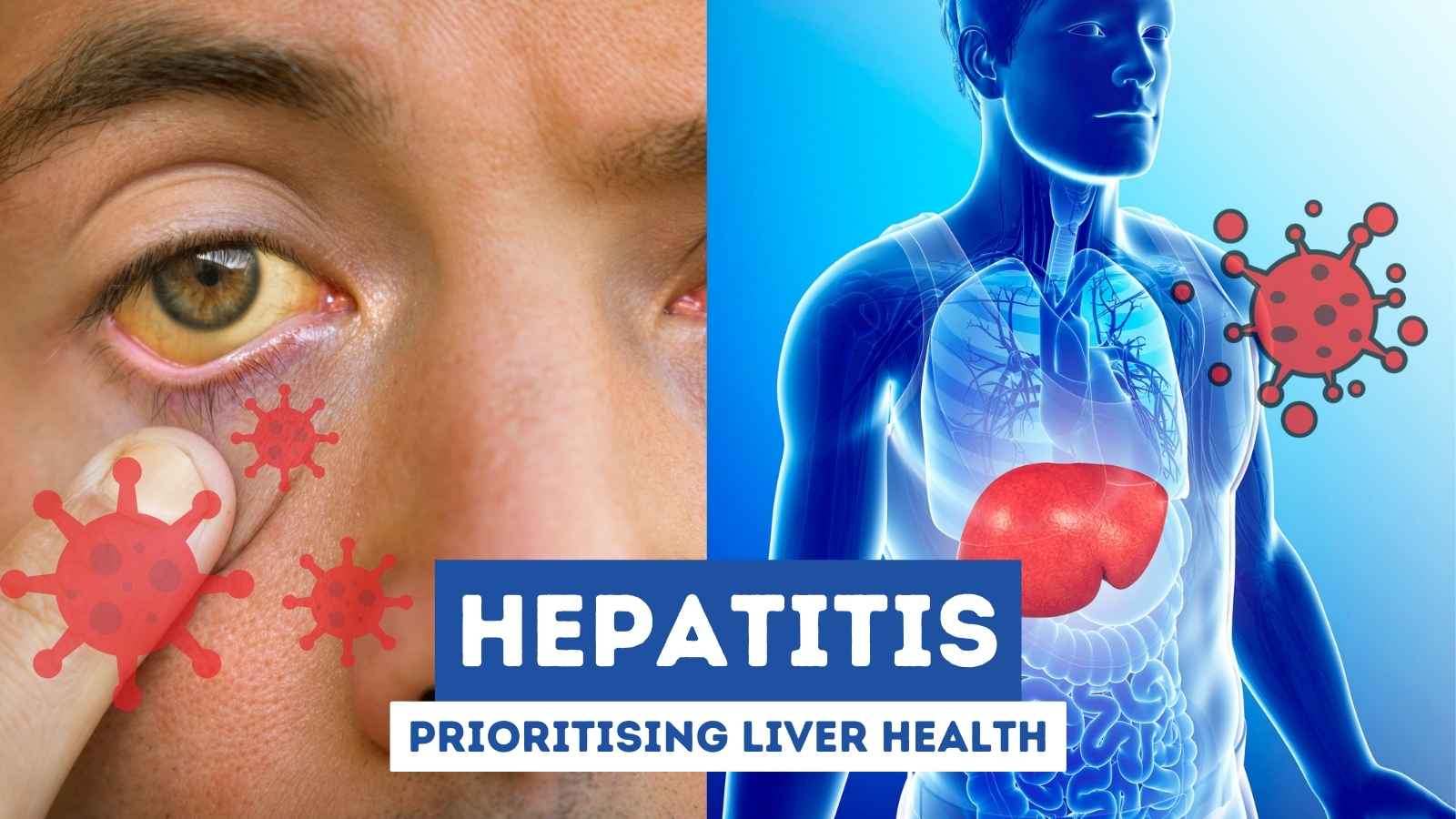 All about Hepatitis Prioritising liver health