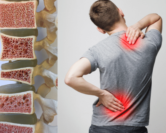 Osteoporosis Exercise for strong bones