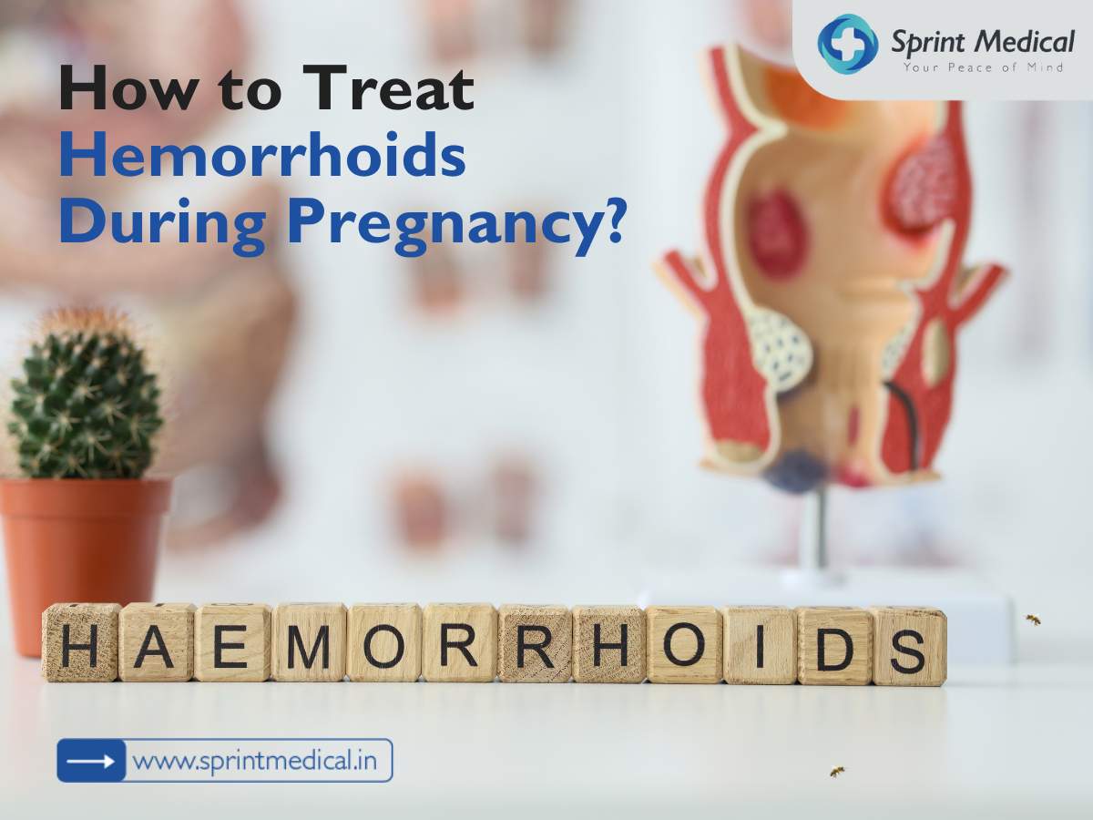 How to treat hemorrhoids during pregnancy