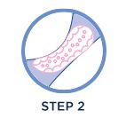 STEP 2