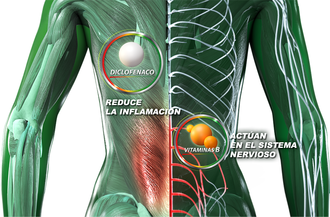 El diclofenaco reduce la inflamación, las vitaminas b actúan sobre el sistema nervioso