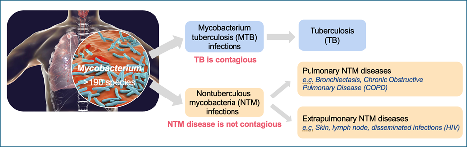 ntb-1