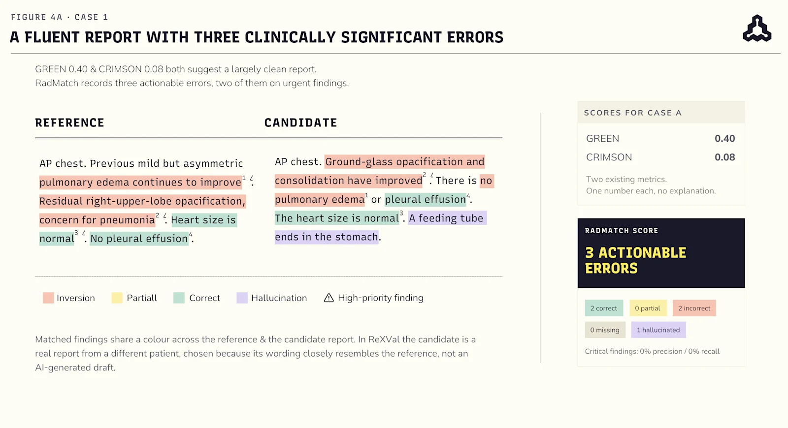 Case 1 A fluent report with three clinically significant errors