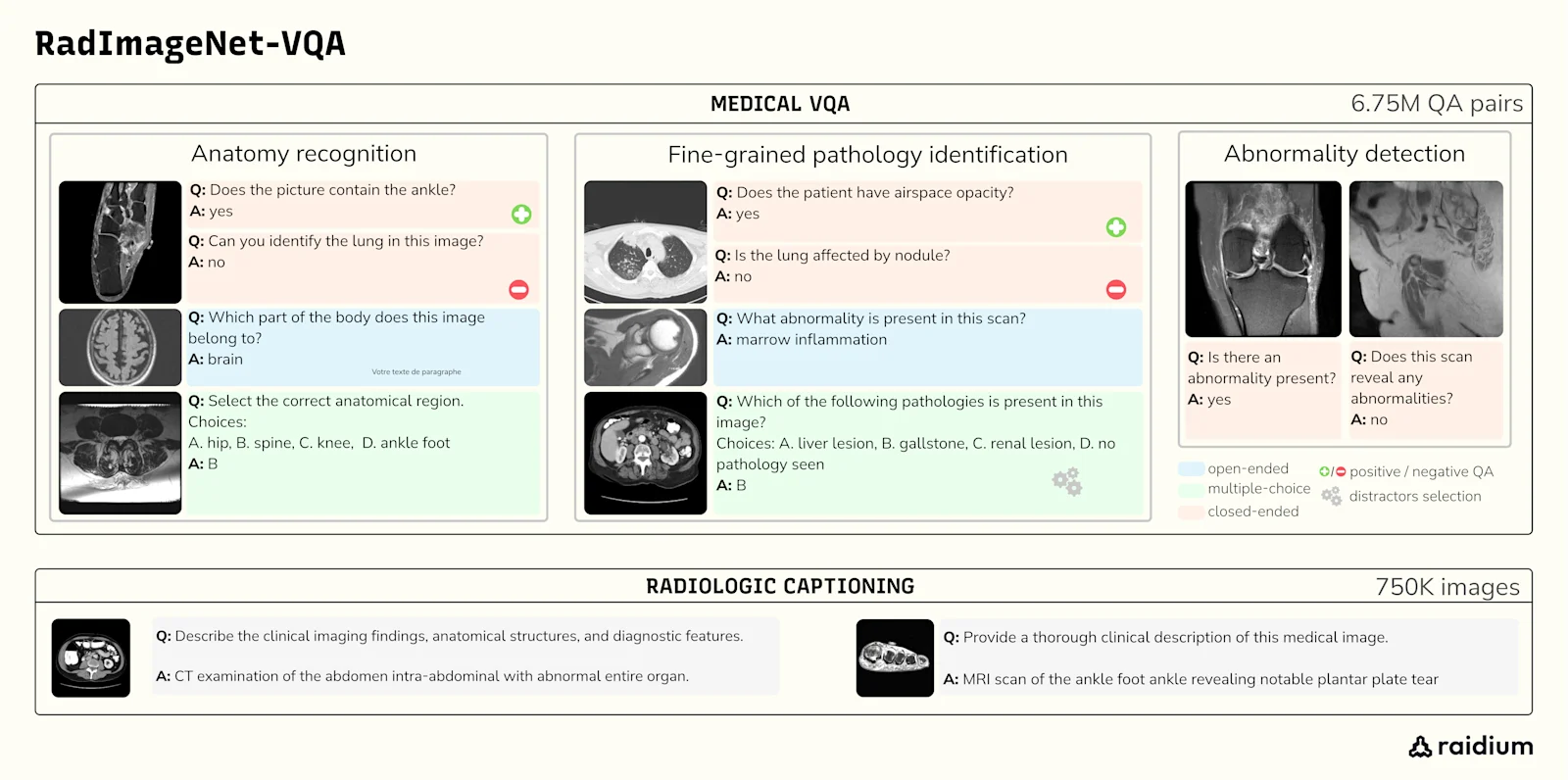 RADIMAGENETVQA Figure1