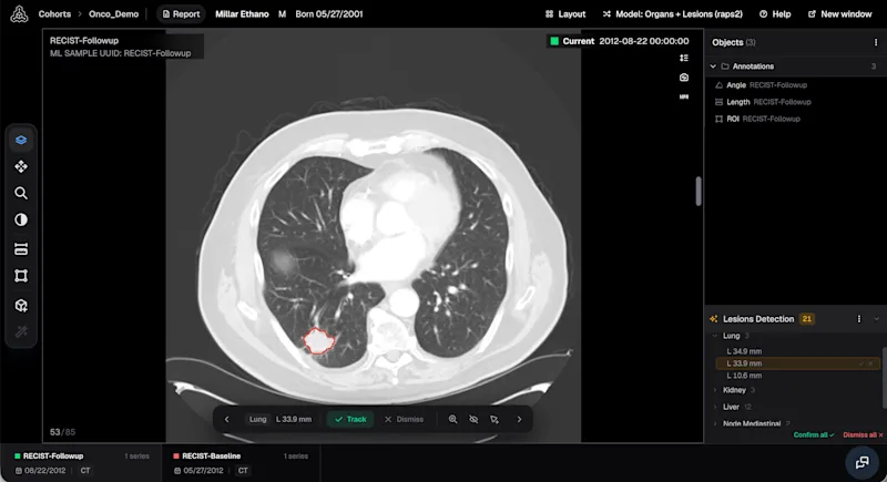 Raidium et CLB s’associent pour accélérer les essais cliniques en oncologie