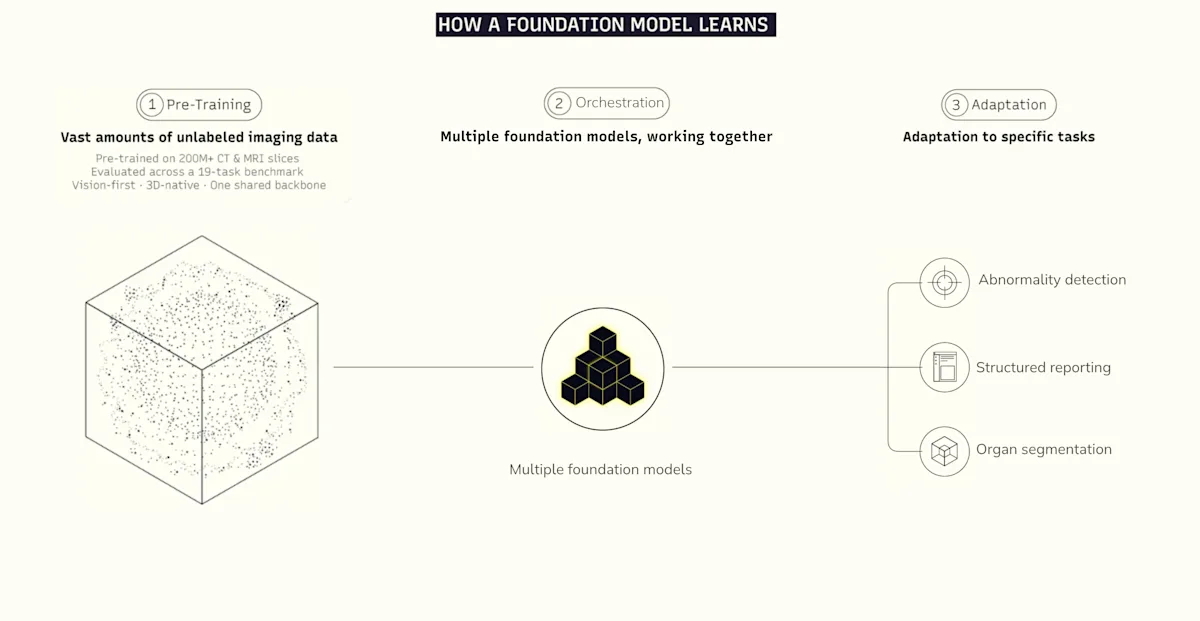 Figure 2: From pre-training to a foundation model-based approach: one shared backbone, many specializations.