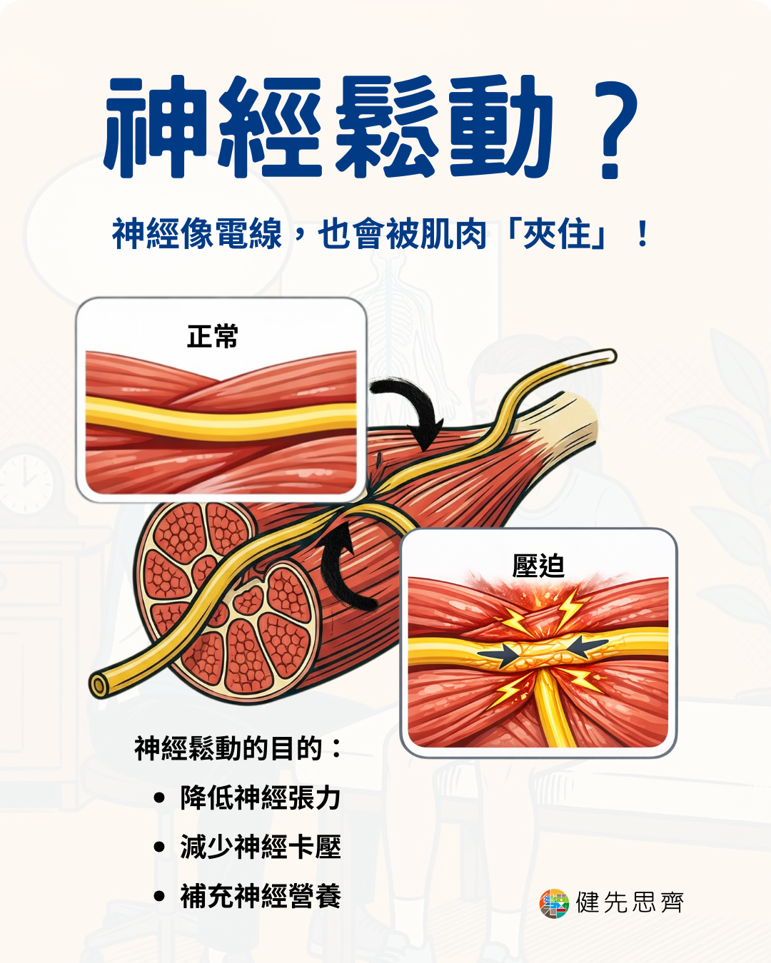 Ep.150 運動後為何需要神經鬆動?