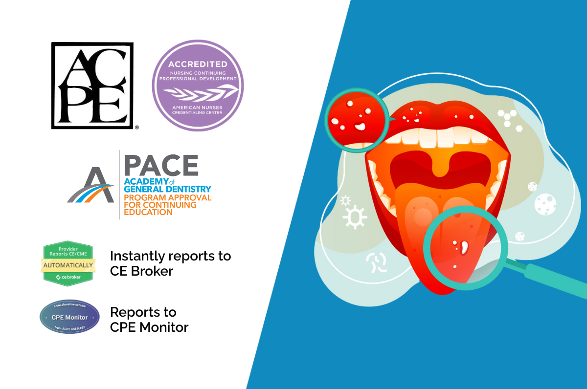 Oral Infections Oral infections