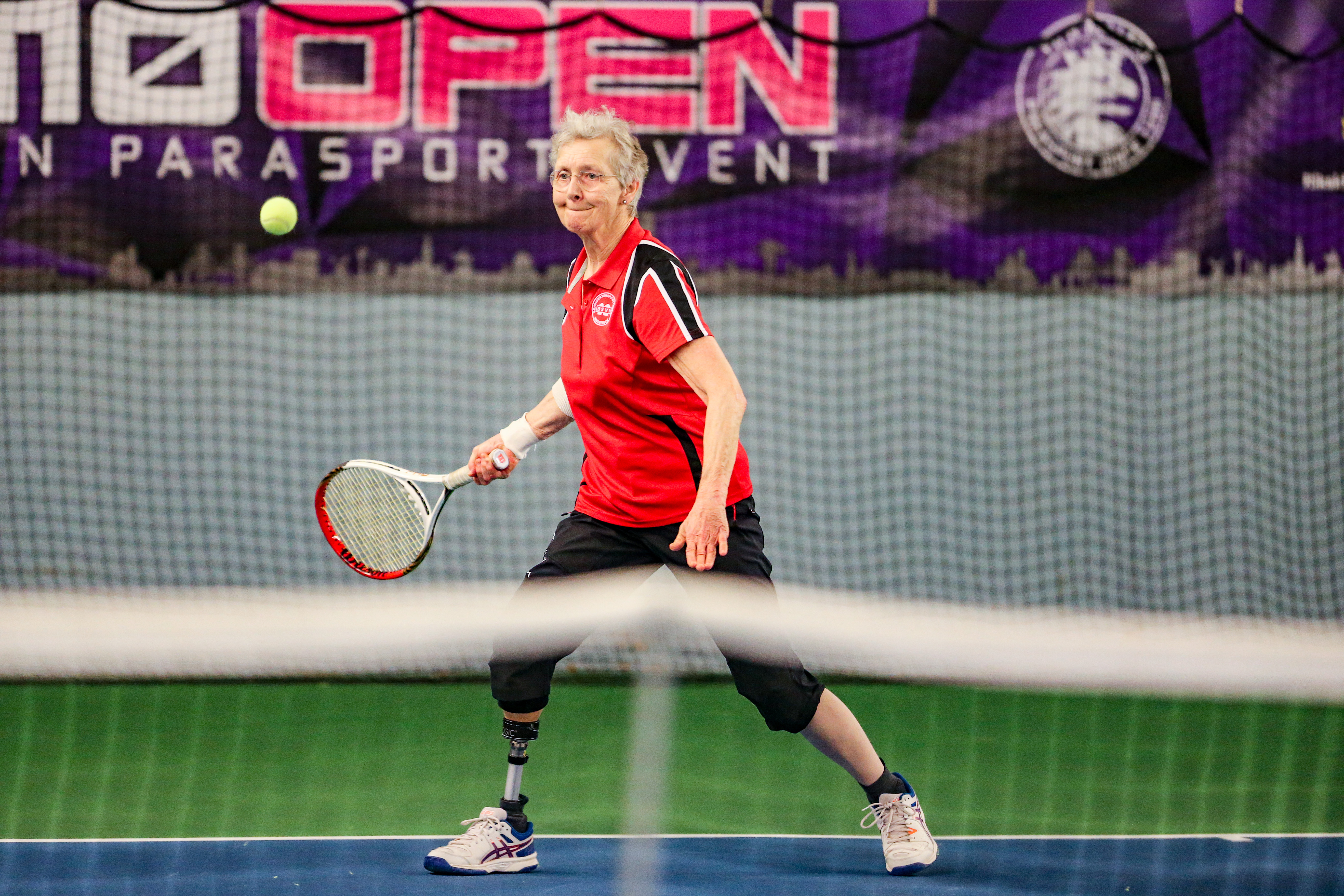 En kvinna med benprotes slår iväg en tennisboll.