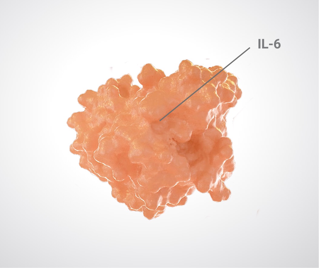 A 3D rendering of IL-6, a protein found in overabundance in people with idiopathic multicentric Castleman disease.