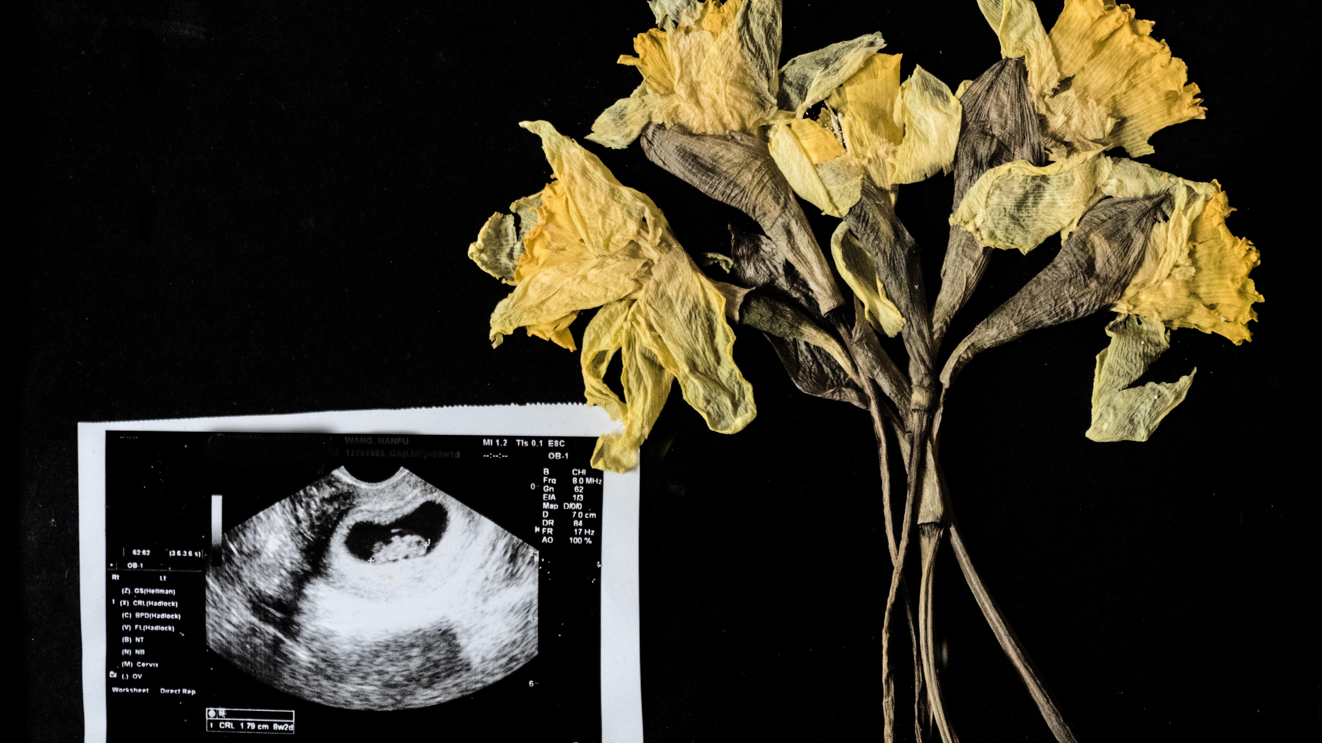 Still from One Child Nation. An image of dying yellow flowers next to an ultrasound image on a black background.