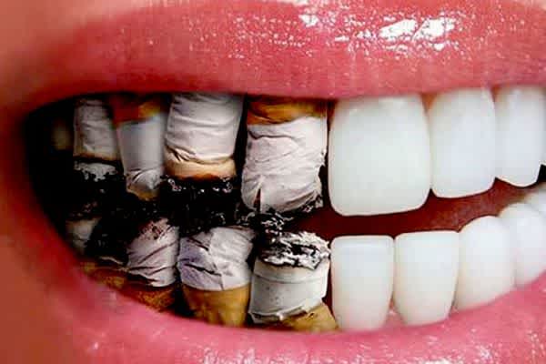 ¿Cómo son los dientes de un fumador?