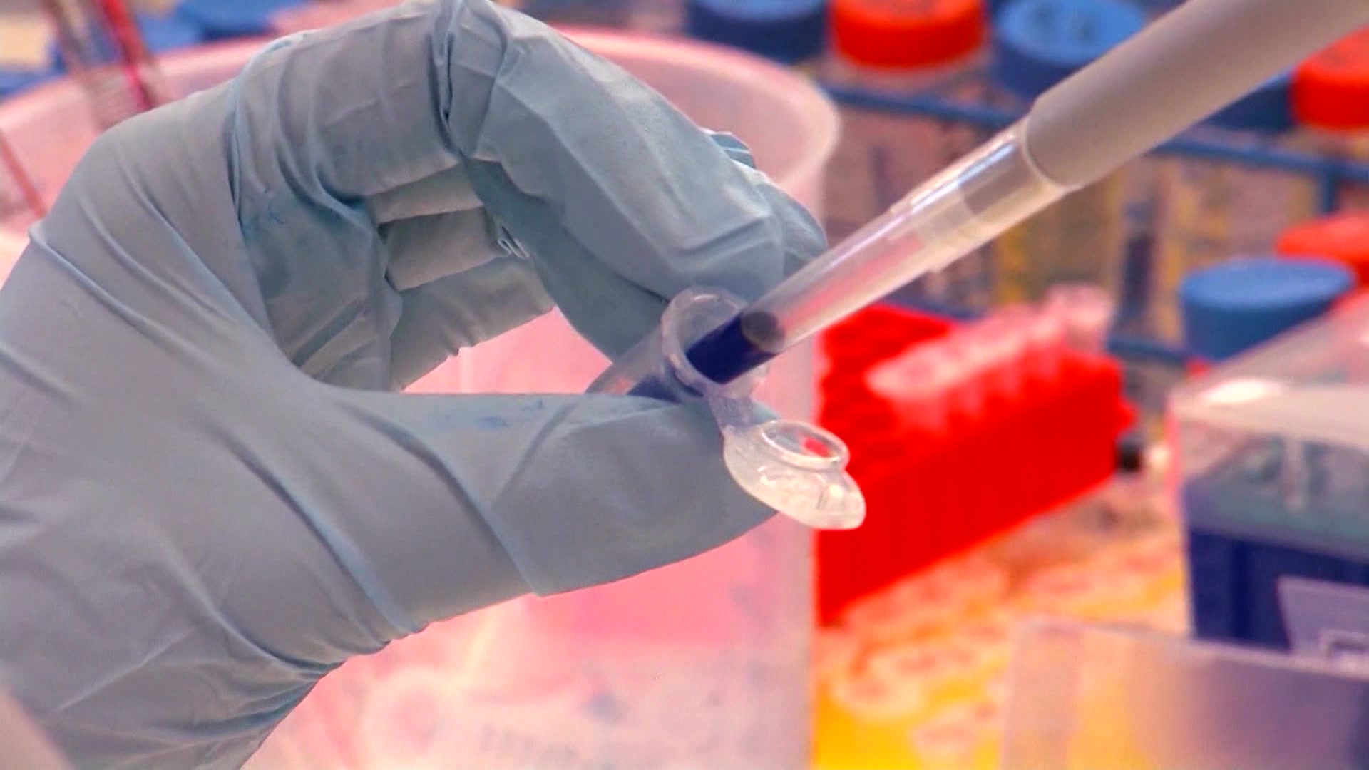 Breast Cancer Screenings MS 1020_2025-10-20-17-27-58