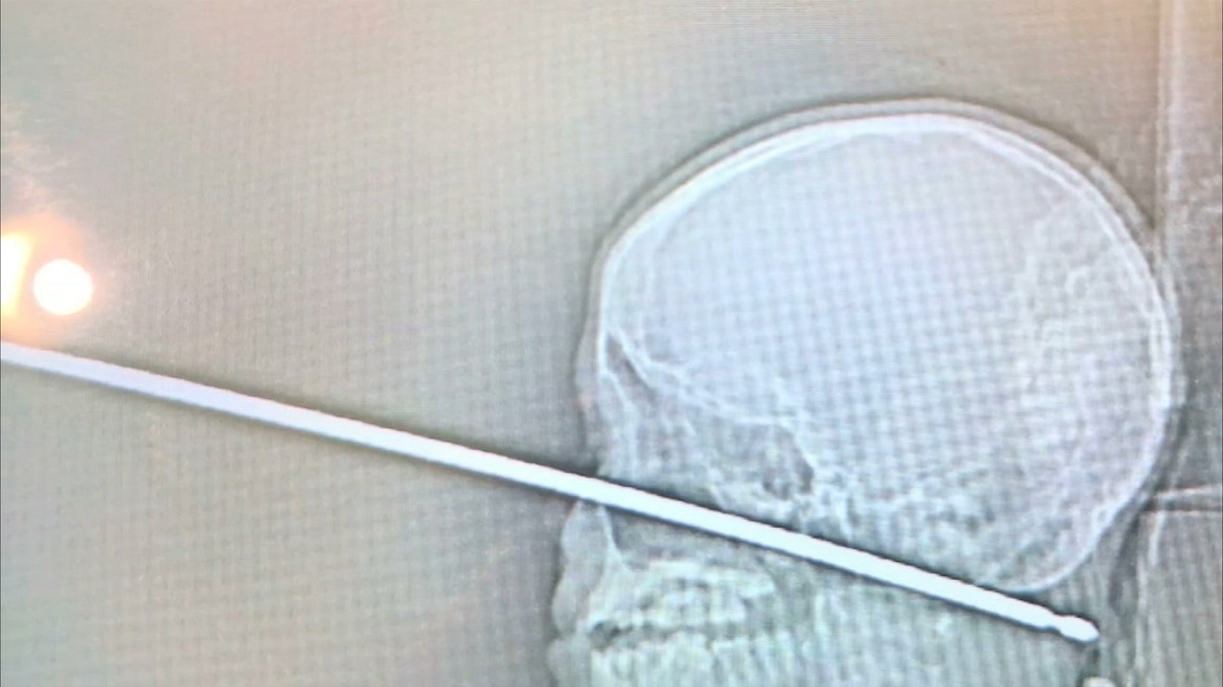 Article 145685 Thumbnail