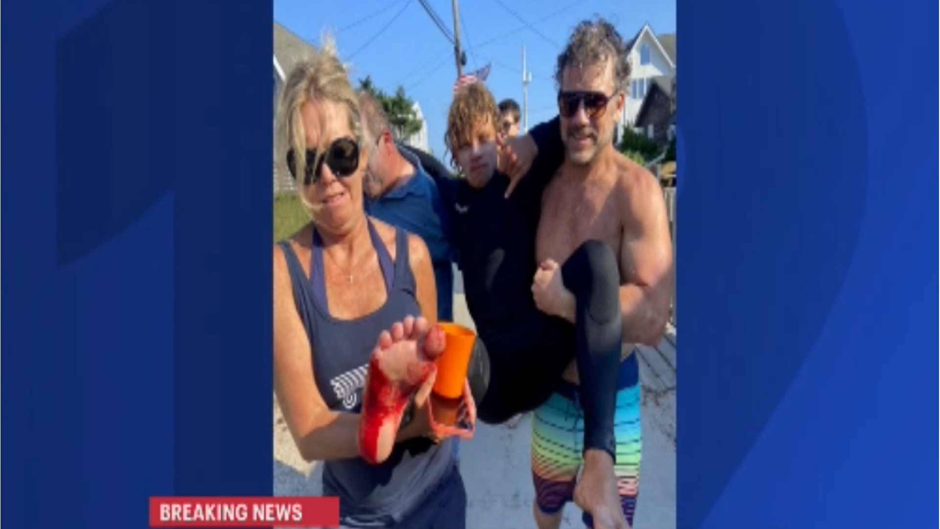 Police 16yearold surfer bitten by shark in Kismet on Fire Island
