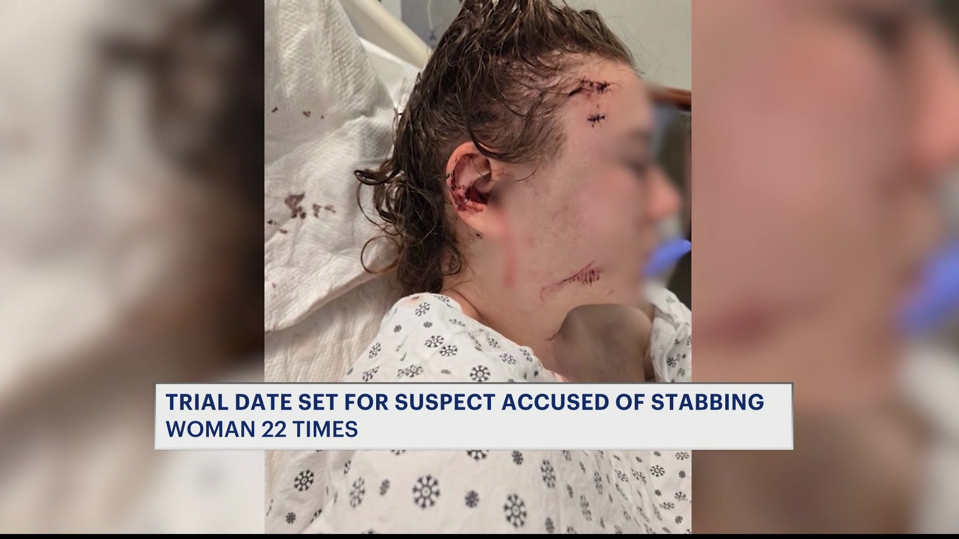 5P STABBING VICTIM SEEKS JUSTICEST_2026-04-08-17-48-43