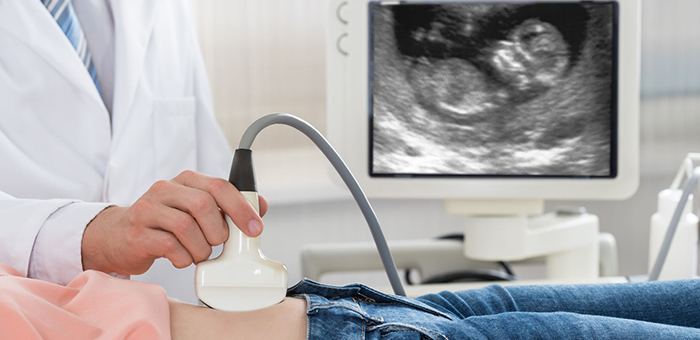 T-Pregnancy ultrasound