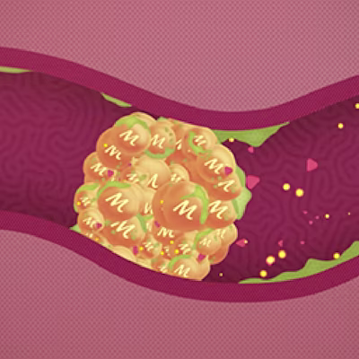 Illustration of viscous gel inside stomach trapping some particles.