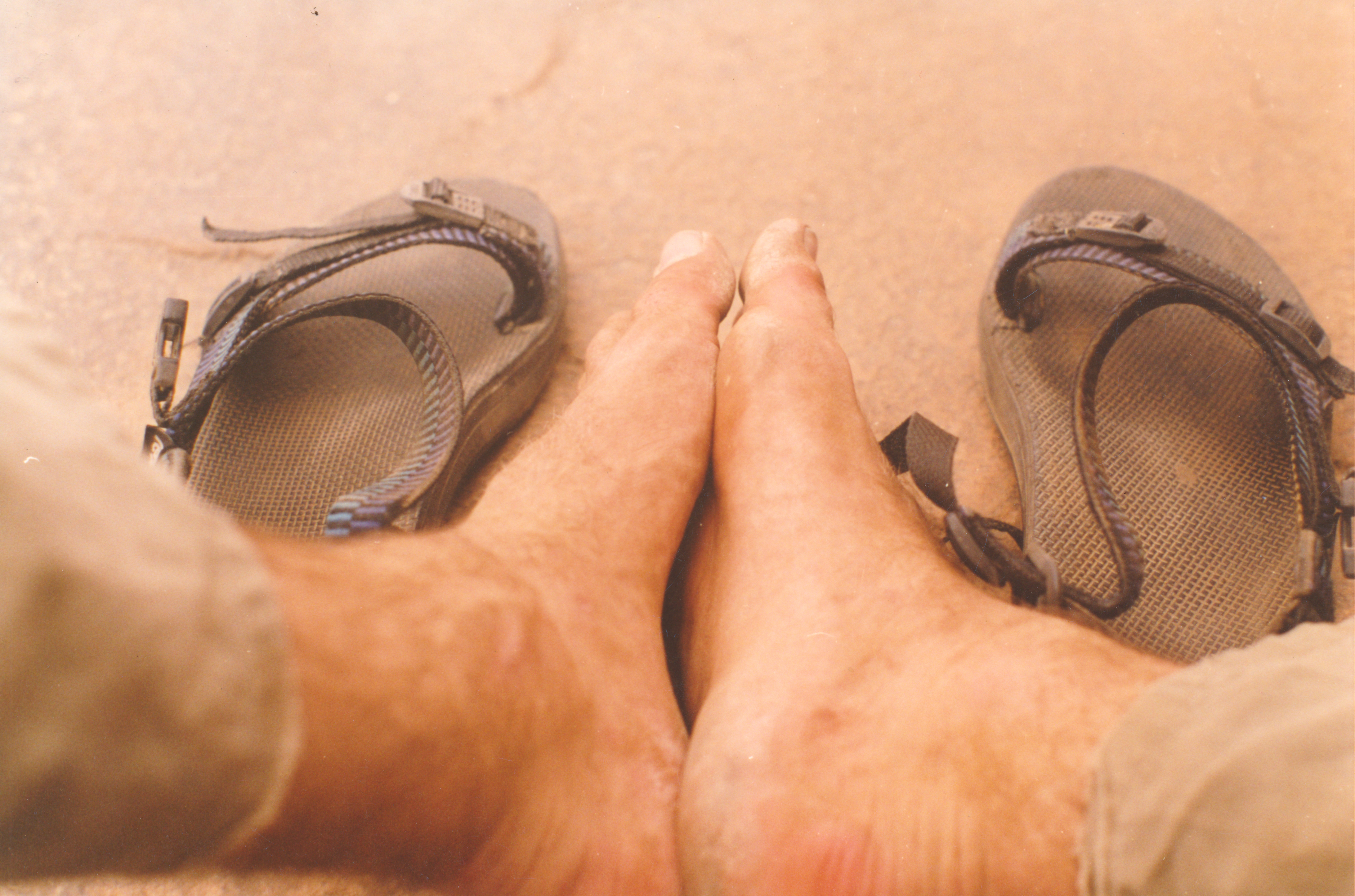 My feet after a hike: dry, calloused, and blistered.