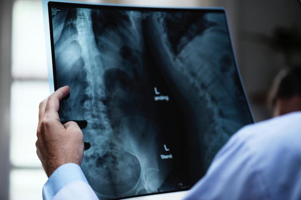 A doctor looking at an x-ray