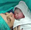 Caesarean Section: Mother and baby after delivery