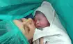 Caesarean Section: Mother and baby after delivery